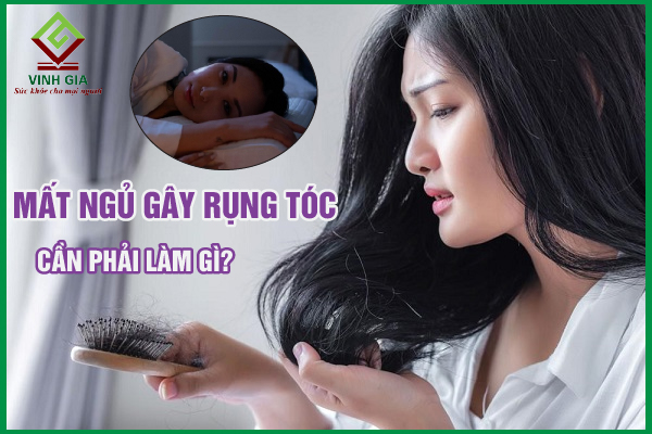Mất ngủ rụng tóc: Hiểu để biết lý do và cách khắc phục tốt nhất