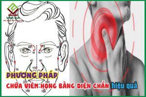 Phương pháp chữa viêm họng bằng diện chẩn hiệu quả nhất