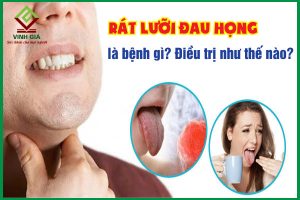 Rát lưỡi đau họng là triệu chứng của bệnh gì và chữa như thế nào?