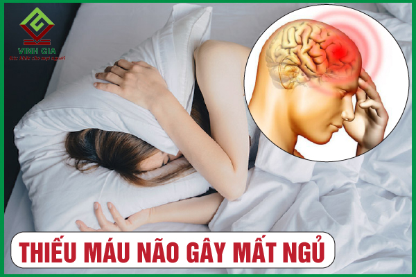 Thiếu máu não mất ngủ: Những ảnh hưởng không tốt đến cơ thể