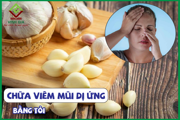 6 Cách chữa viêm mũi dị ứng bằng tỏi an toàn ngay tại nhà