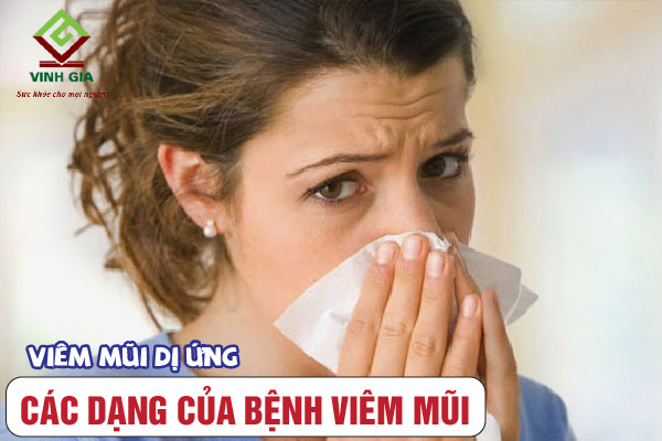 Dạng viêm mũi phổ biến có thể kể đến viêm mũi dị ứng