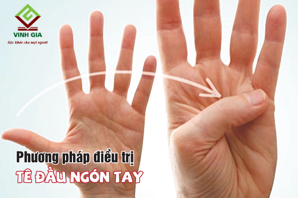 Người bệnh nên tập các bài tập duỗi ngón tay để chữa tê nhức tay