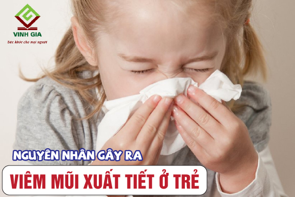 Nguyên nhân gây ra bệnh viêm mũi xuất tiết ở trẻ nhỏ