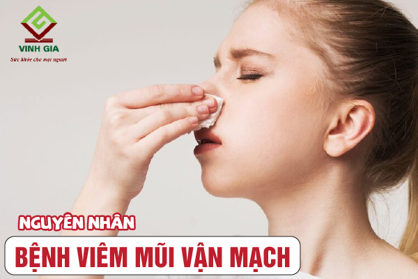 Những tác nhân chính gây ra tình trạng viêm mũi vận mạch