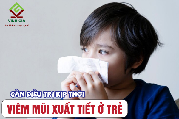 Trẻ bị viêm mũi xuất tiết nên được điều trị kịp thời tránh những rủi ro không đáng có