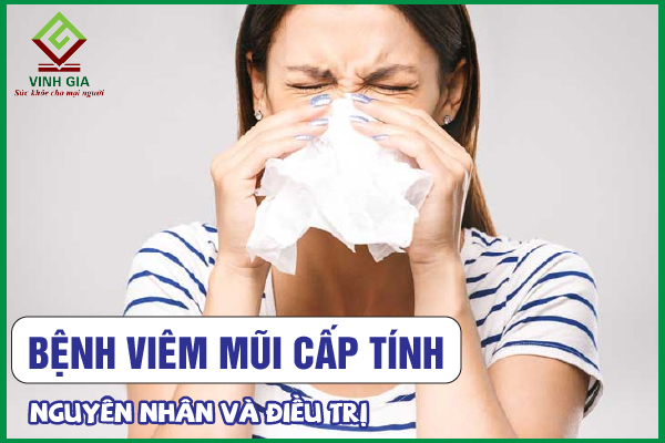 Viêm mũi cấp tính: Nguyên nhân và cách điều trị hiệu quả