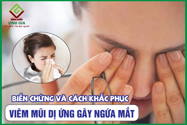 Viêm mũi dị ứng gây ngứa mắt cùng biến chứng nguy hiểm