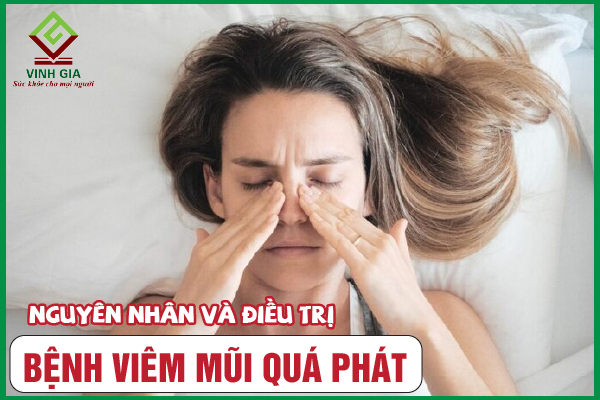 Viêm mũi quá phát là gì? Cần điều trị như thế nào tốt nhất?