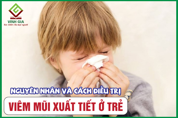 Viêm mũi xuất tiết ở trẻ em: Nhận biết để điều trị cho đúng
