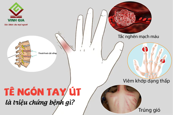 Bị tê 2 ngón tay út và áp út có thể là dấu hiệu của nhiều bệnh lý