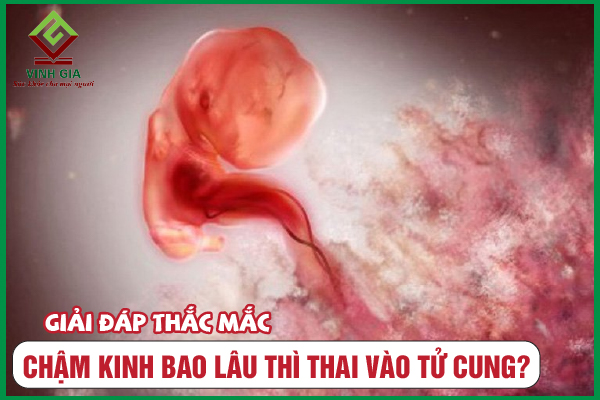 [CẨM NANG] Chậm kinh bao lâu thì thai vào tử cung?