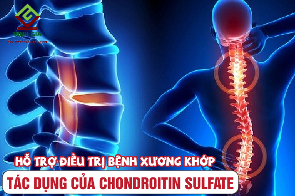 Chondroitin sulfate giúp hỗ trợ điều trị bệnh xương khớp