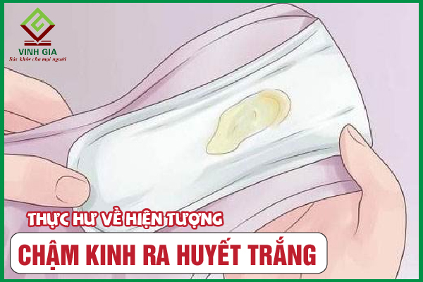 Hiện tượng trễ kinh ra huyết trắng cảnh báo bệnh gì?