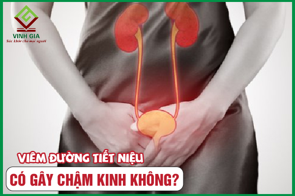 [Thắc mắc] Viêm đường tiết niệu có bị chậm kinh không?