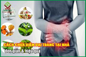 8 cách chữa viêm đại tràng tại nhà đơn giản, hiệu quả