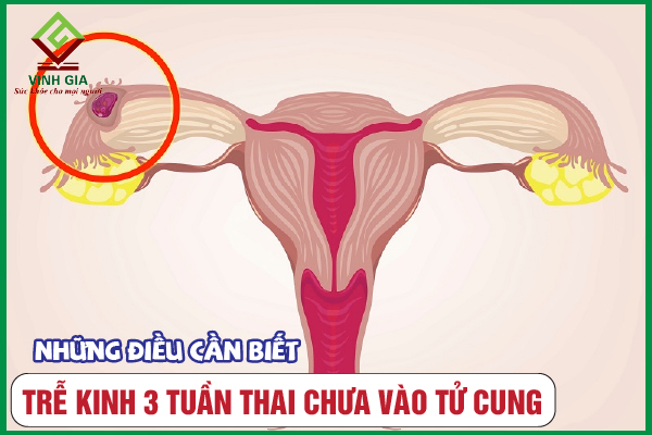 Chậm kinh 3 tuần thai chưa vào tử cung có nguy hiểm không?