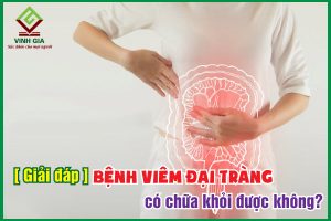 Người bệnh quan tâm: Bệnh viêm đại tràng có chữa khỏi được không?