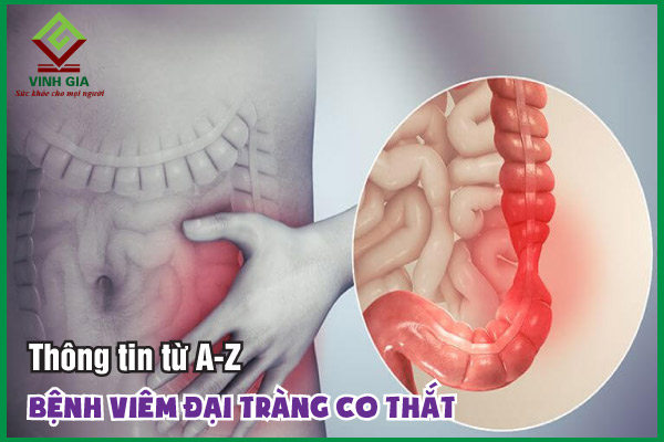 Viêm đại tràng co thắt: Nguyên nhân, dấu hiệu và cách cải thiện