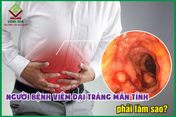 Viêm đại tràng mãn tính: Nguyên nhân và cách cải thiện