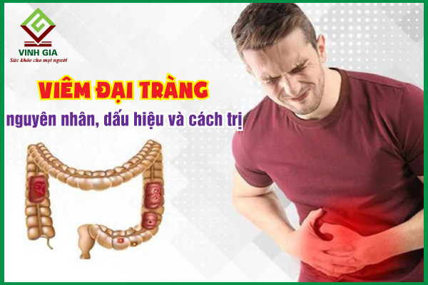 Viêm đại tràng: Nguyên nhân, triệu chứng và cách cải thiện