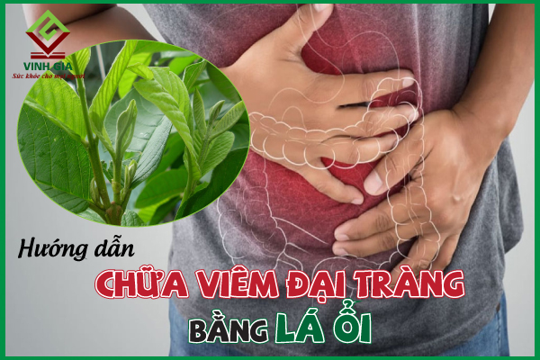 5 mẹo giảm viêm đại tràng bằng lá ổi đơn giản và hiệu quả