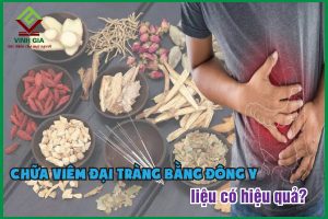 Chữa viêm đại tràng bằng đông y: Có nên không và cần lưu ý gì?