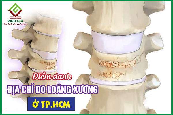 Top 10 địa chỉ đo loãng xương ở TP.HCM uy tín hiện nay