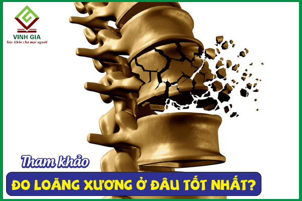 Đo loãng xương ở đâu tốt? Những địa chỉ uy tín hiện nay