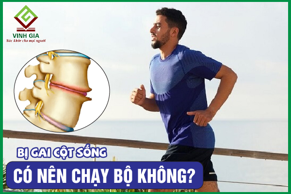 [CẨM NANG] Người bị gai cột sống có nên đi bộ không?