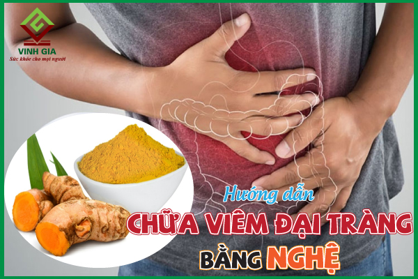 Top 4 cách giảm viêm đại tràng bằng nghệ cực hiệu quả