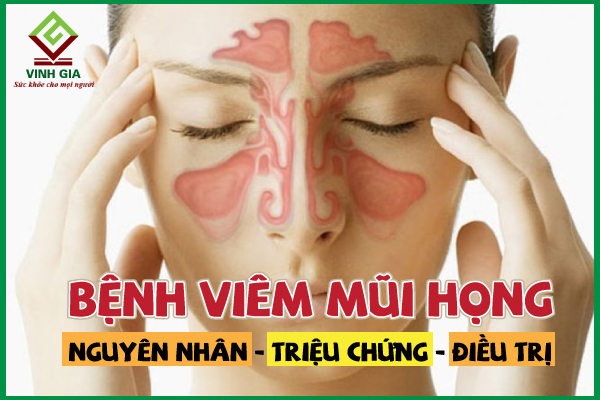 Viêm mũi họng: Nguyên nhân, triệu chứng và cách điều trị