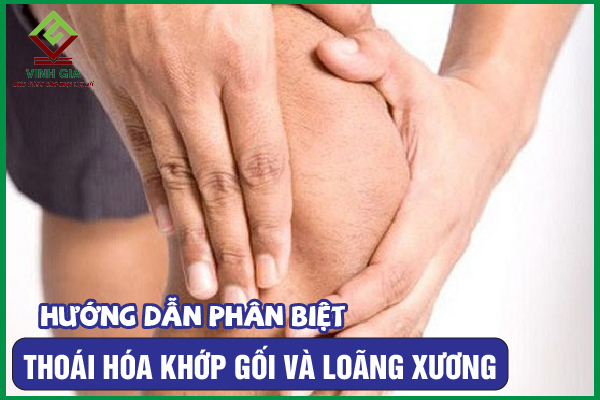 [CẨM NANG] Phân biệt thoái hóa khớp gối và loãng xương
