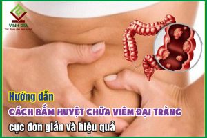 Bật mí cách bấm huyệt chữa viêm đại tràng cực hiệu quả