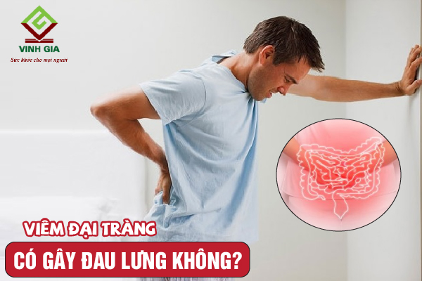 Bệnh viêm đại tràng có gây đau lưng không?