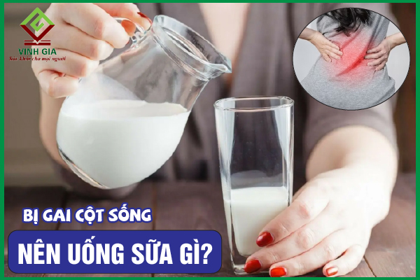 Bị gai cột sống nên uống sữa gì để nhanh cải thiện bệnh?