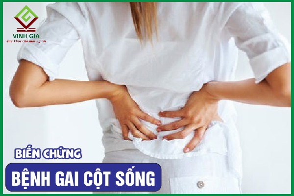 Các biến chứng gai cột sống nguy hiểm cần phải biết