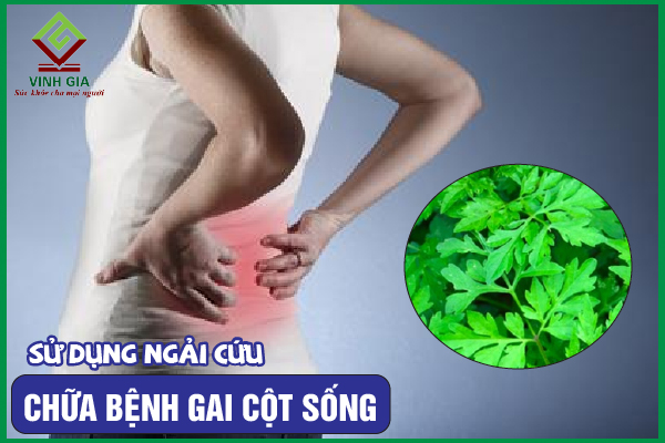4 Cách cải thiện gai cột sống bằng ngải cứu dễ áp dụng