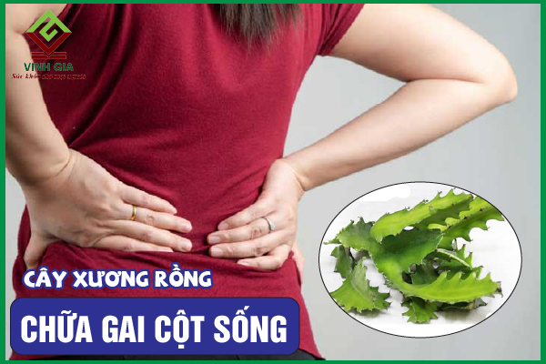 8 Cách dùng cây xương rồng cải thiện bệnh gai cột sống