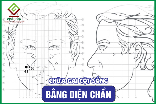 Các bước khắc phục gai cột sống bằng diện chẩn chuẩn
