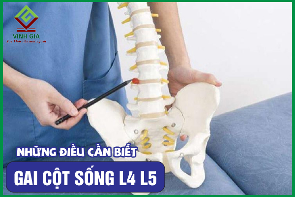 Gai cột sống L4 L5: Nguyên nhân, triệu chứng và giải pháp