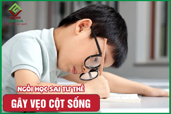 Ngồi học sai tư thế gây gù vẹo cột sống: Cần phải làm sao?