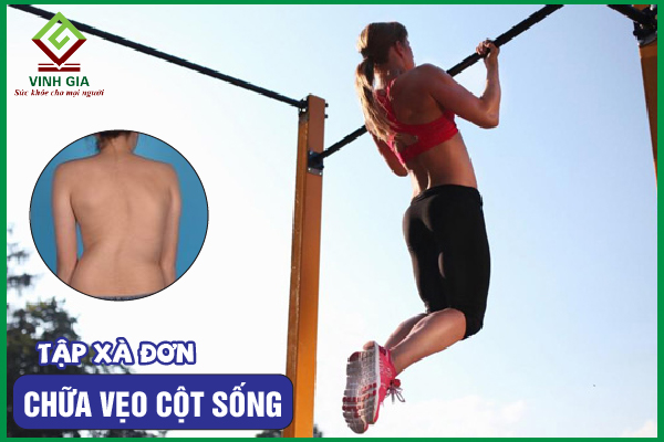 Cách tập xà đơn chữa vẹo cột sống đơn giản, hiệu quả nhất