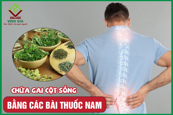 8 Bài thuốc nam khắc phục gai cột sống hữu ích