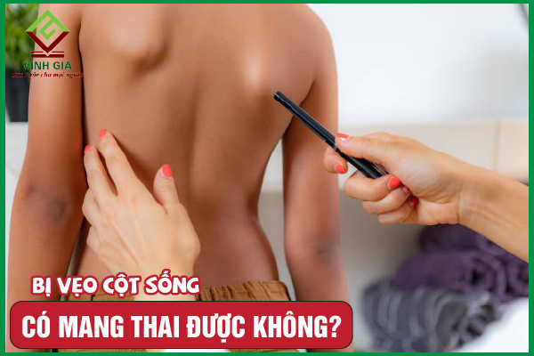 [CẨM NANG] Vẹo cột sống có mang thai được không?