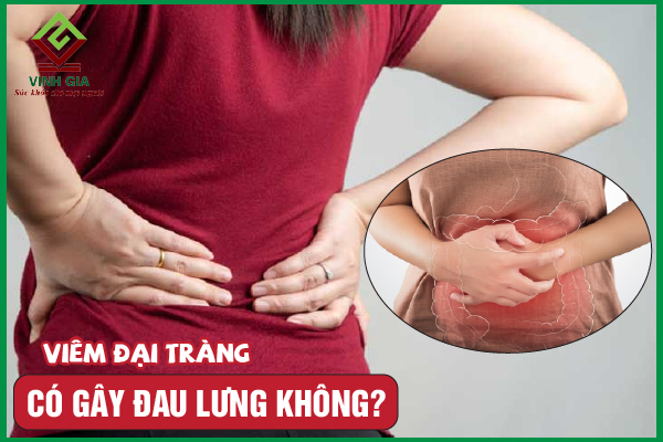 [CẨM NANG] Viêm đại tràng có gây đau lưng không?