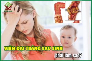 Viêm đại tràng sau sinh: Nguyên nhân và cách chữa trị