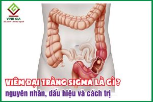 Viêm đại tràng sigma: Nguyên nhân, triệu chứng và phương pháp điều trị