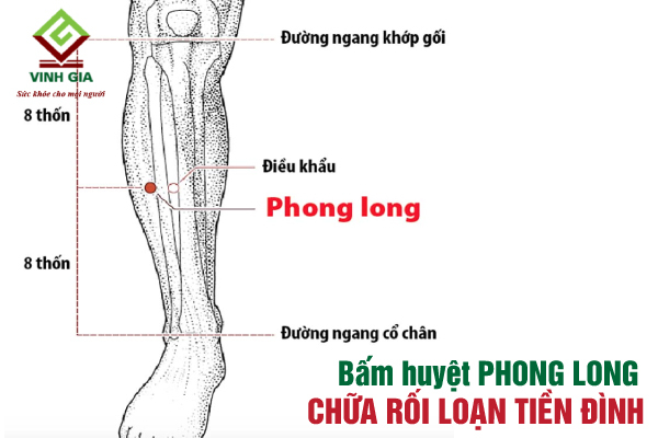 Bấm huyệt Phong Long giúp giảm đau đầu, chóng mặt buồn nôn Bấm huyệt Phong Long giúp giảm đau đầu, chóng mặt buồn nôn