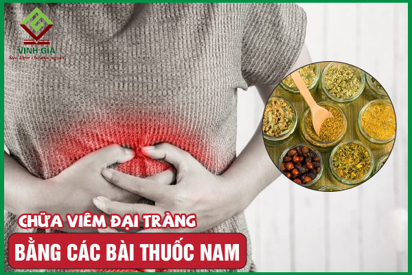 16 Bài thuốc nam giúp giảm viêm đại tràng được áp dụng nhiều
